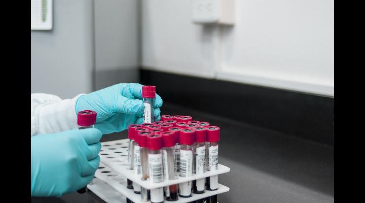 De luna aceasta începe Campania de testare pentru depistarea hepatitelor virale B/D și C în județul Prahova